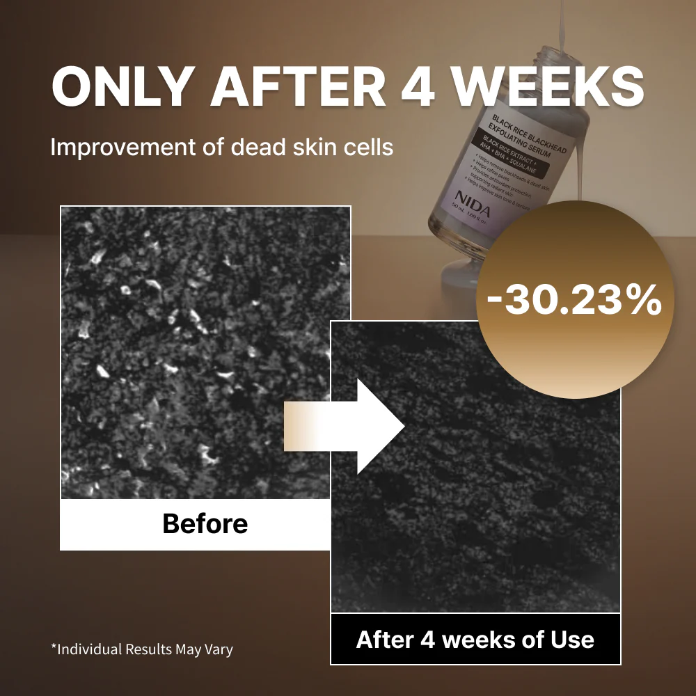 NIDA Black Rice Blackhead Exfoliating Serum - Image 4