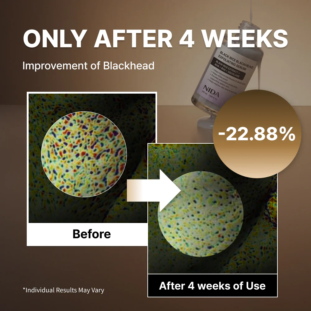 NIDA Black Rice Blackhead Exfoliating Serum - Image 5