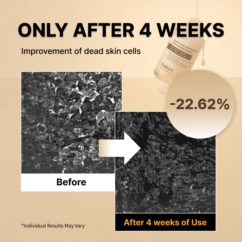 NIDA White Rice Whitehead Exfoliating Serum - Image 4